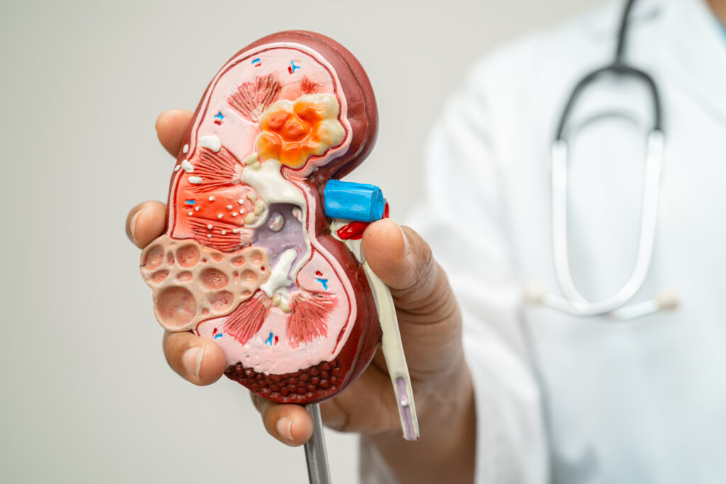 Early Signs and Symptoms of Chronic Kidney Disease 