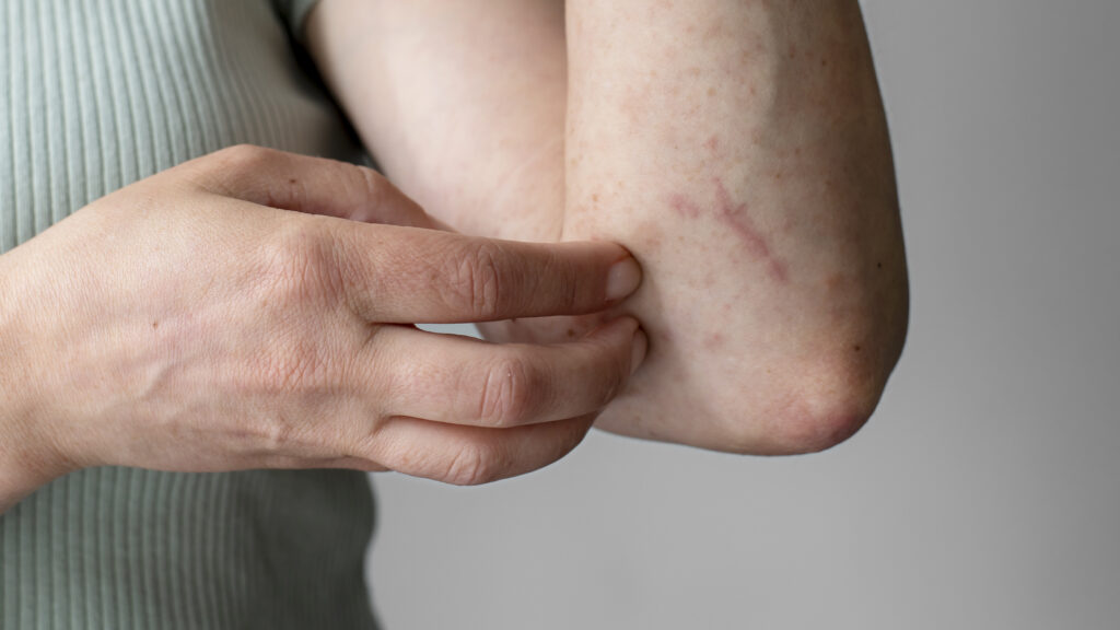 Fungal Infections: Causes, Types, and Treatments
