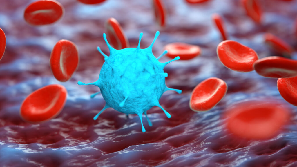 ​Sickle Cell Disease: Causes, Symptoms, Diagnosis & Treatment
