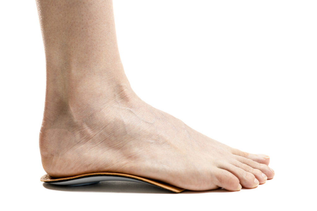 How to Identify Flat Feet Symptoms and Choose the Right Treatment