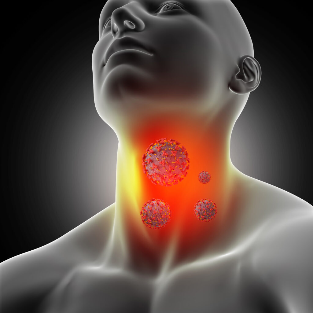 Throat Infection: Causes, Symptoms, and  Effective Treatments